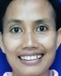 ANI WIYANI ANI WIYANI